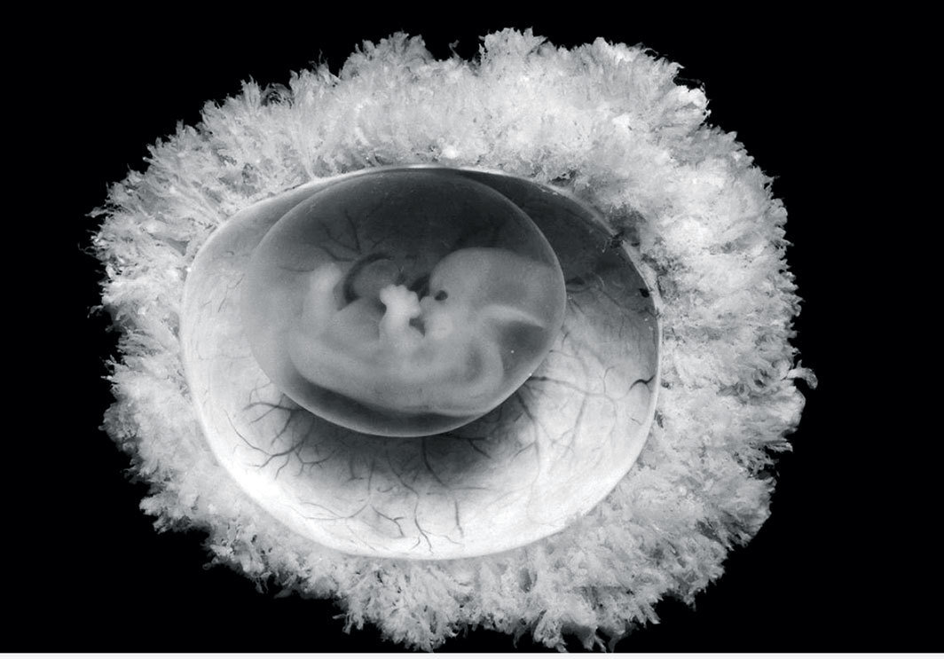怀孕35天胚胎图图片